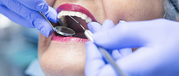 Best Emergency Tooth Extraction in Park Hills, MO